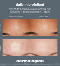 Dermalogica Daily Microfoliant 2.6oz